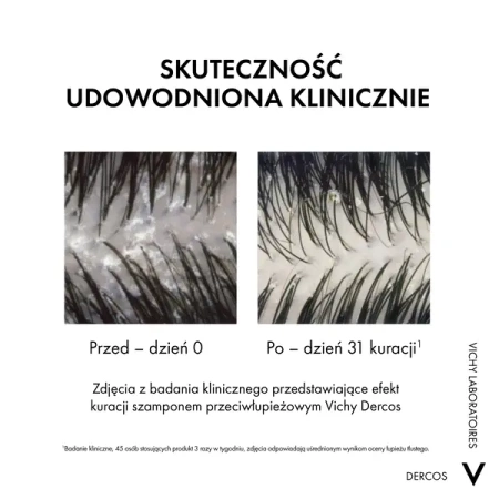Vichy Dercos DS Szampon Przeciwłupieżowy z Odżywką 2w1, 200ml