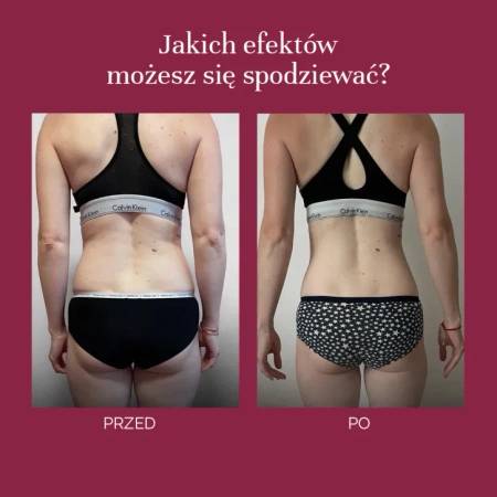 MyBestSkinny Suplement Diety w Proszku o Smaku Wiśniowym, 250g