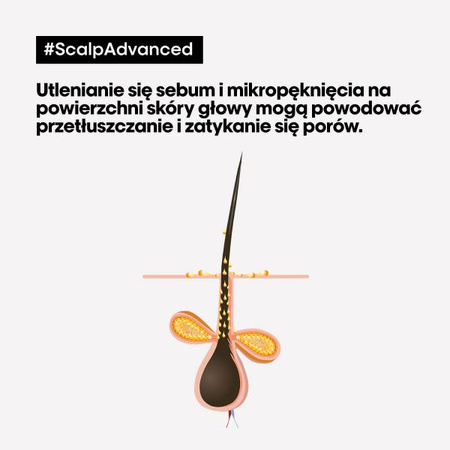 L’Oreal Professionnel Scalp Advanced Anti-Oiliness – Szampon Oczyszczający, 300ml