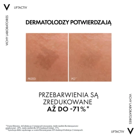 VICHY LiftActiv Specialist [B3] Serum Redukujące Przebarwienia i Zmarszczki, 30ml