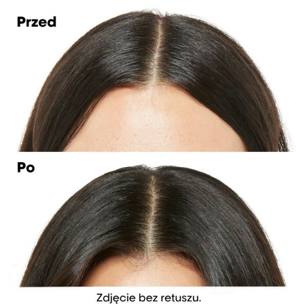 L’Oreal Professionnel Scalp Advanced Anti-Discomfort – Szampon Kojący, 300ml