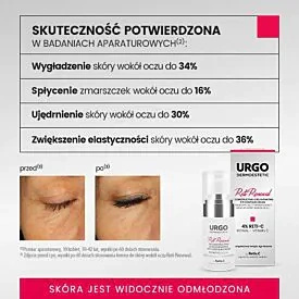 Urgo Dermoestetic Reti Renewal Krem Odbudowująco-Odmładzający do Skóry Wokół Oczu 4% RETI-C, 15ml | KRÓTKA DATA: 31.12.2025R.