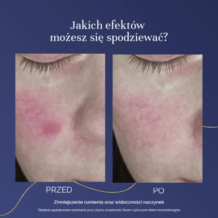 MyBestCollaGen - Wsparcie dla Zdrowej Skóry, 150 kapsułek 
