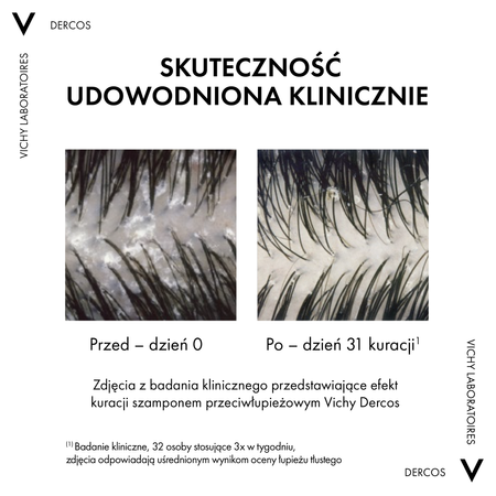 VICHY Dercos DS Szampon Przeciwłupieżowy do Włosów Normalnych i Przetłuszczających się, 390ml