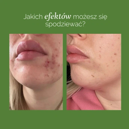 MyBestComplement Brzoskwiniowy– Suplement dla Zdrowej Skóry i Mózgu, 250ml