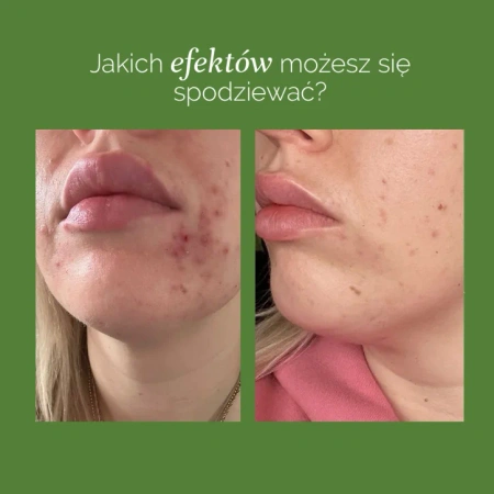 MyBestComplement Brzoskwiniowy– Suplement dla Zdrowej Skóry i Mózgu, 250ml